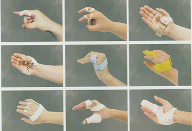 <!--<$[标题]>begin-->手-手指矫形器<!--<$[标题]>end-->